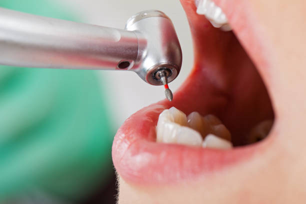 Best Urgent Dental Care for Toothache in Fort Branch, IN